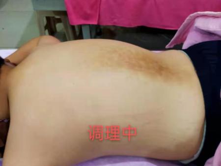 脊椎问题调理